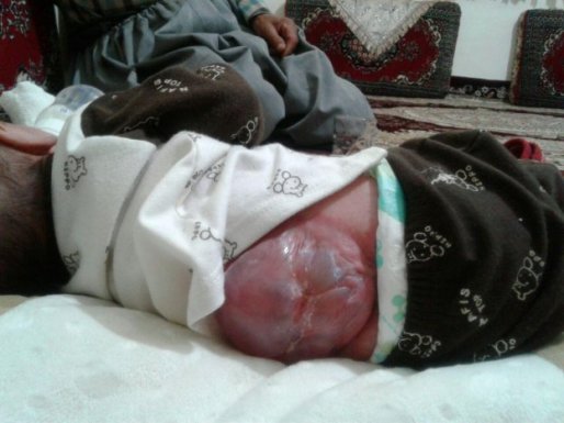 پنج بهار تا خزان عمر یک نوزاد مریوانی / ماجرای قصور پزشکان در کردستان